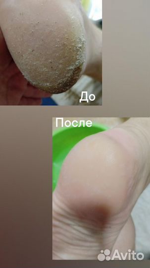 Маникюр и педикюр