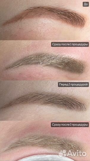 Удаление татуажа/тату ремувером/лазером, Перманент