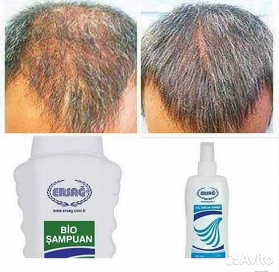 Био шампунь ersag Против выпадения волос
