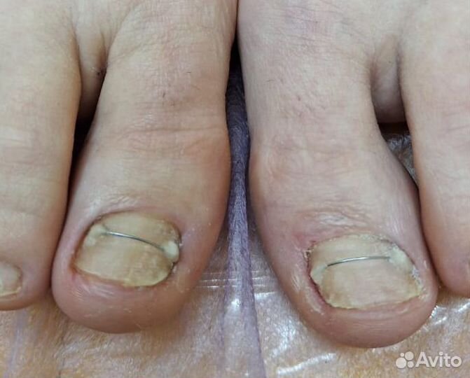 Педикюр Подолог Ленинский проспект