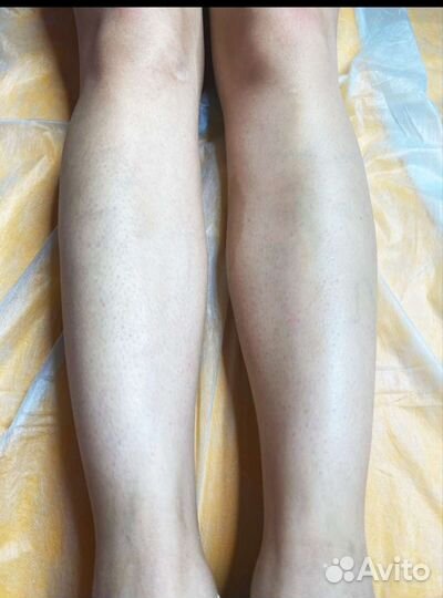 Депиляция воском: глубокое бикини