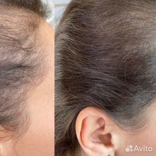 Перманентный камуфляж