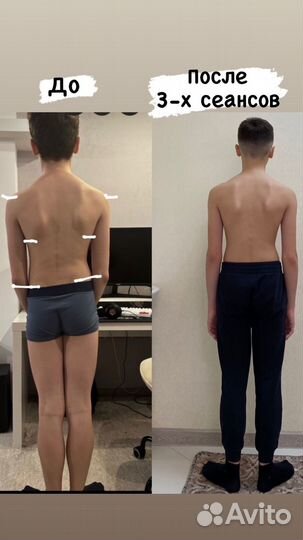 Устраняю боль, исправляю осанку