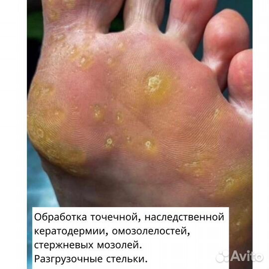 Подолог. Педикюр