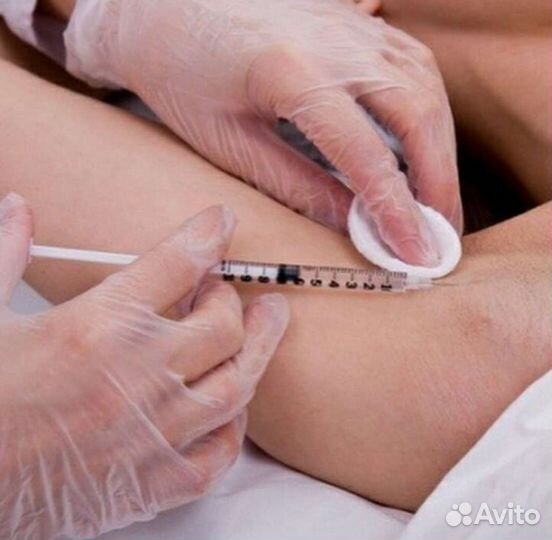 Ботокс в подмышки