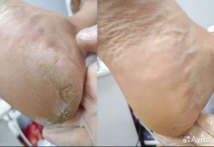 Маникюр педикюр наращивание ногтей