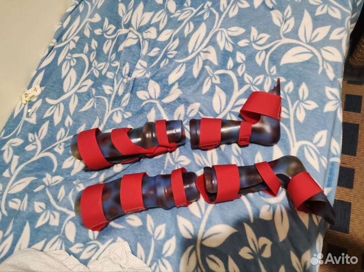 Ортез/съёмный гипс