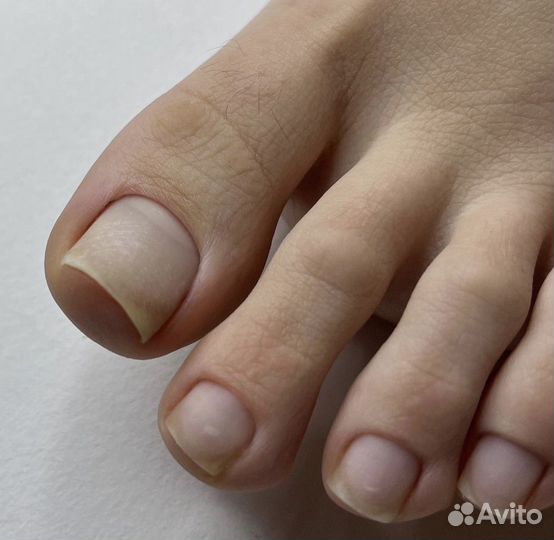 Педикюр, подолог