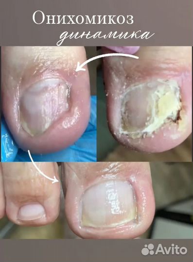 Услуги Подолога 49-39-29