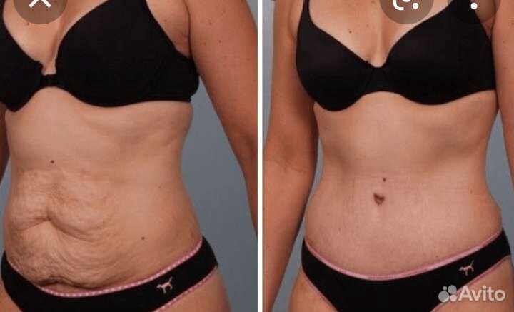 Моменталиное сжигание жиров