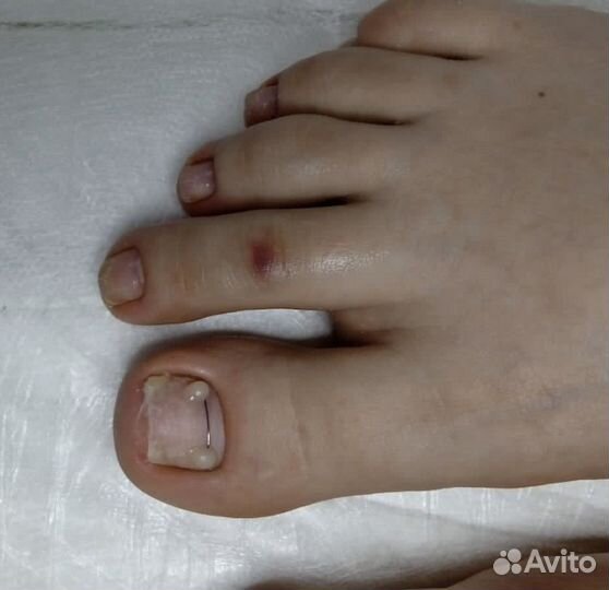 Наращивание ногтей,укрепление,гель -лак,подолог