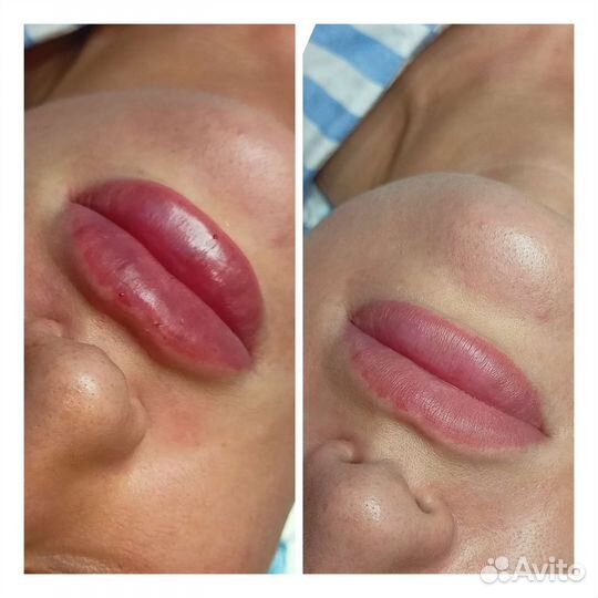 Услуги косметолога