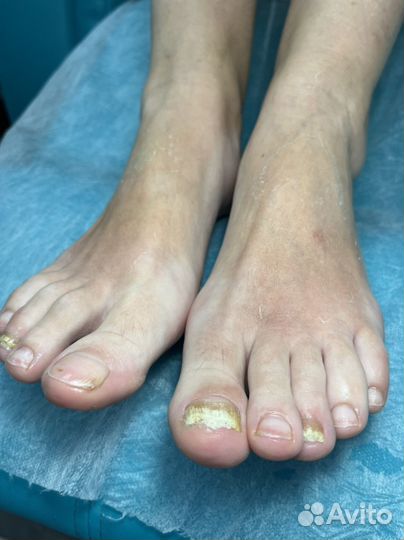 Требуется модели на курсы по подологии