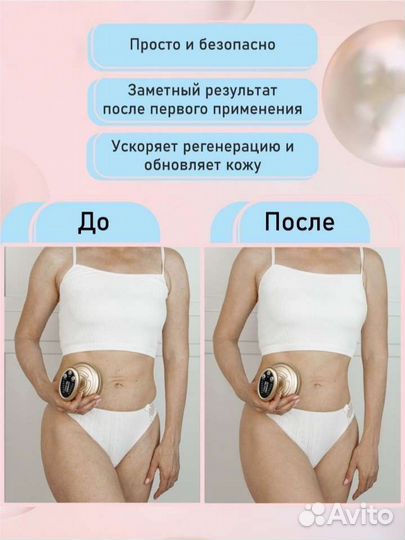 Массажер Антицелюлитный