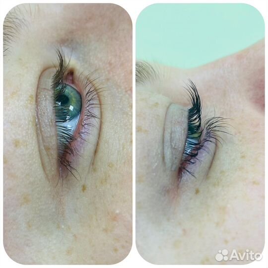 Стрейчинг ресниц