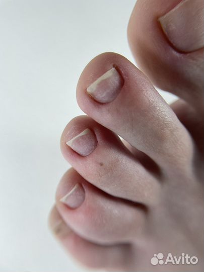 Эстетический педикюр