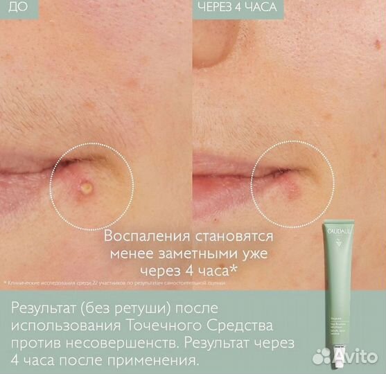 Caudalie новое средство от воспалений и прыщиков