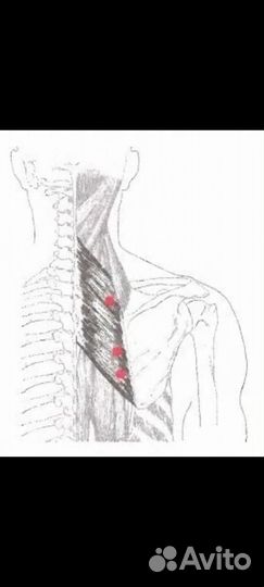 Массаж Восстановительный