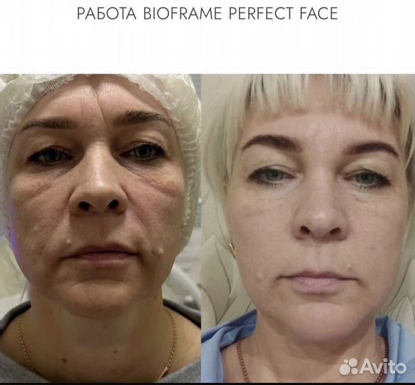 Услуги косметолога