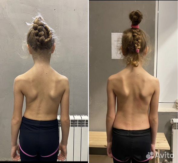 Коррекция осанки,устранение болей зажимов или спаз