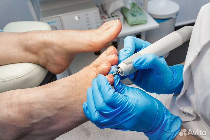 Подолог. Лечебный педикюр. Без боли