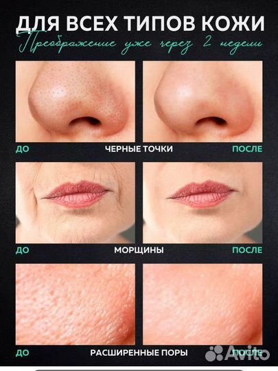 Косметолог чистка лица