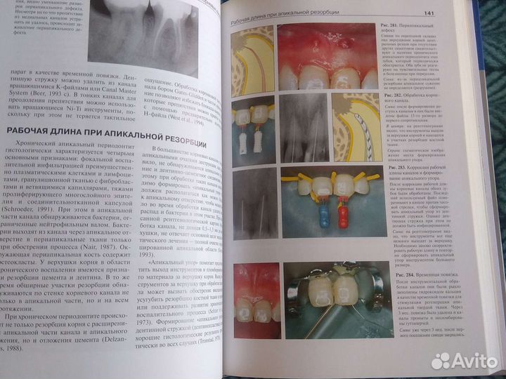 Эндодонтология под ред.Виноградовой