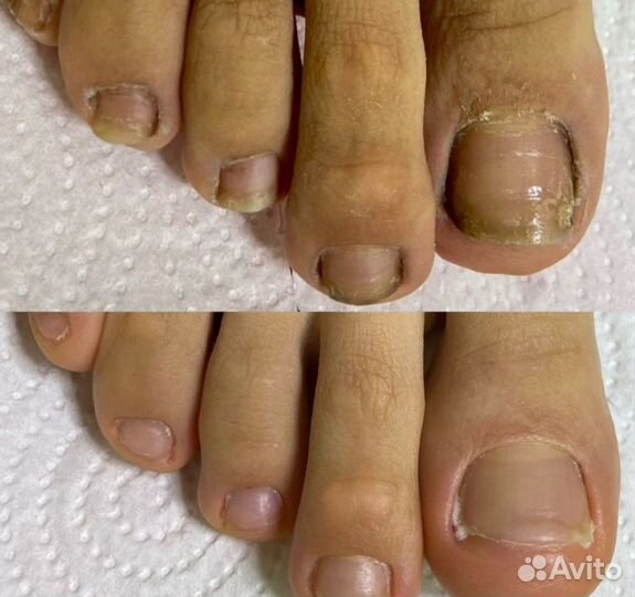 Педикюр подолог маникюр