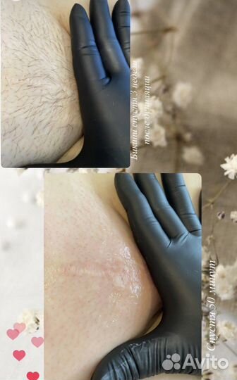 Мастер шугаринга