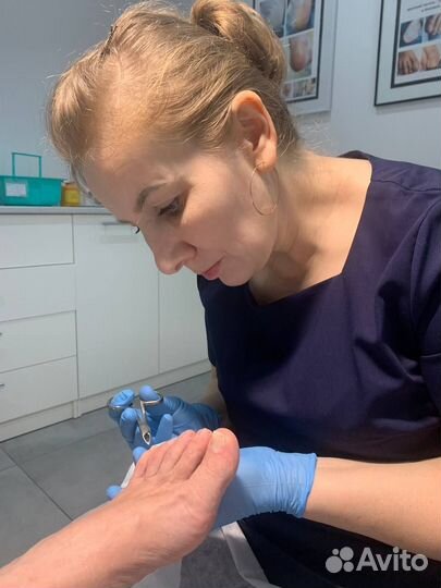 Медицинский педикюр подолог