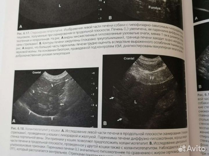 Атлас по ультразвуковой диагностике исследования