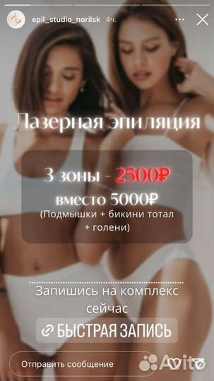 Лазерная эпиляция