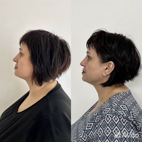 Массаж лица