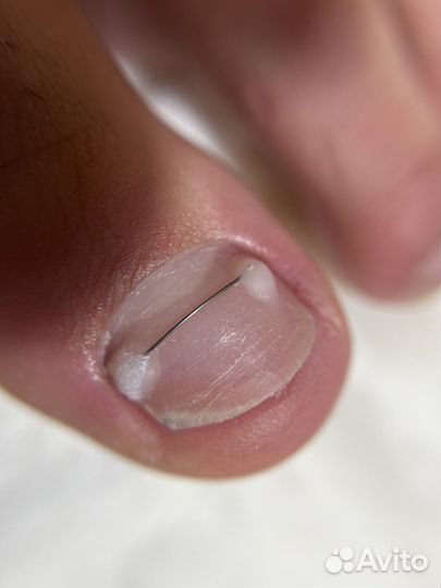 Услуги подолога