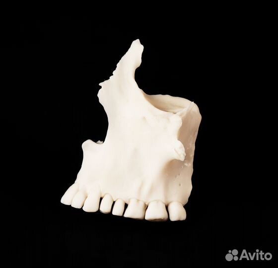 Анатомический макет верхней челюсти