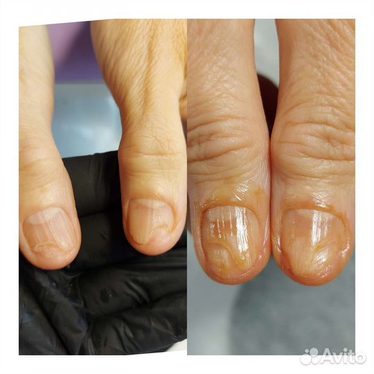 Аппаратный маникюр