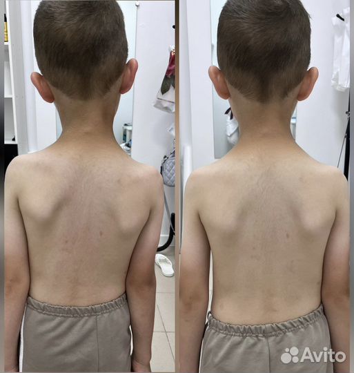 Детский массаж