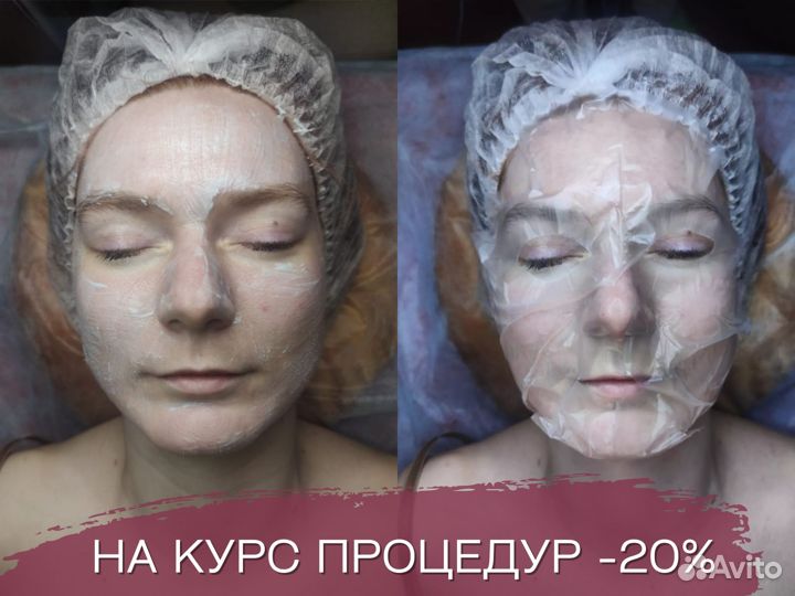 Косметолог, чистка лица, пилинги