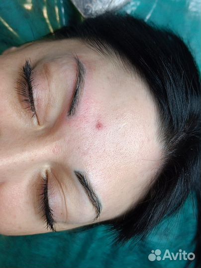 Осветление перманентного макияжа и татуажа