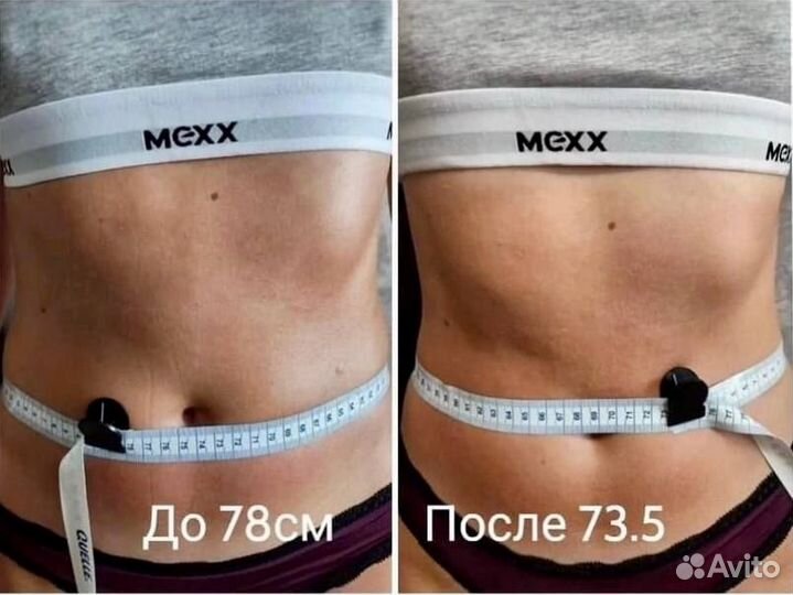 Коррекция фигуры. Lpg массаж