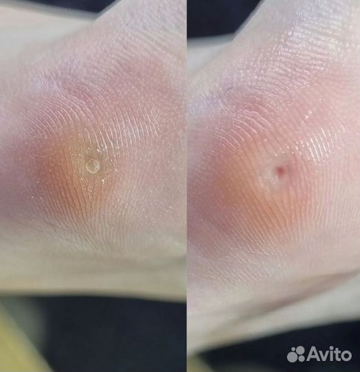 Подолог, маникюр, педикюр