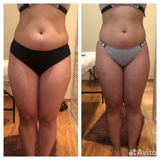 Антицеллюлитный массаж