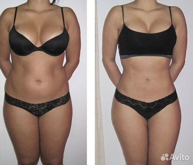 Антицеллюлитный массаж