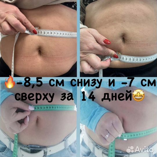 Кетгут похудение/акупунктурный фейслифтинг