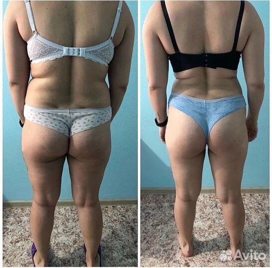 Альтернатива LPG. Программа похудения