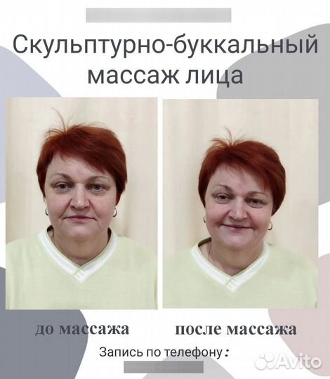Скульптурно-буккальный массаж лица