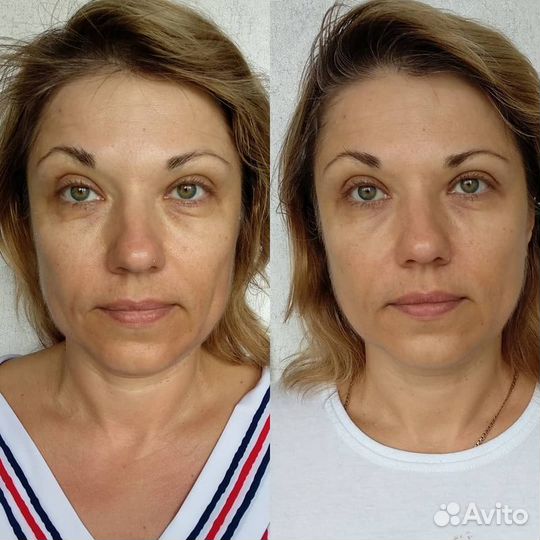 Скульптурно-буккальный массаж, уход за лицом