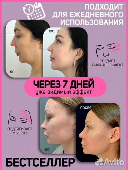 Бандаж для лица