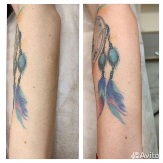 Шугаринг / Восковая Депиляция / Курчатовский район