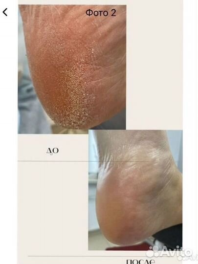 Маникюр, педикюр